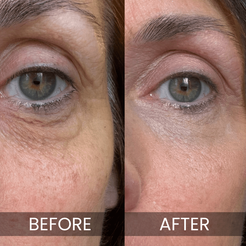 Luxe - Korean Under-Eye Balm - The Closet