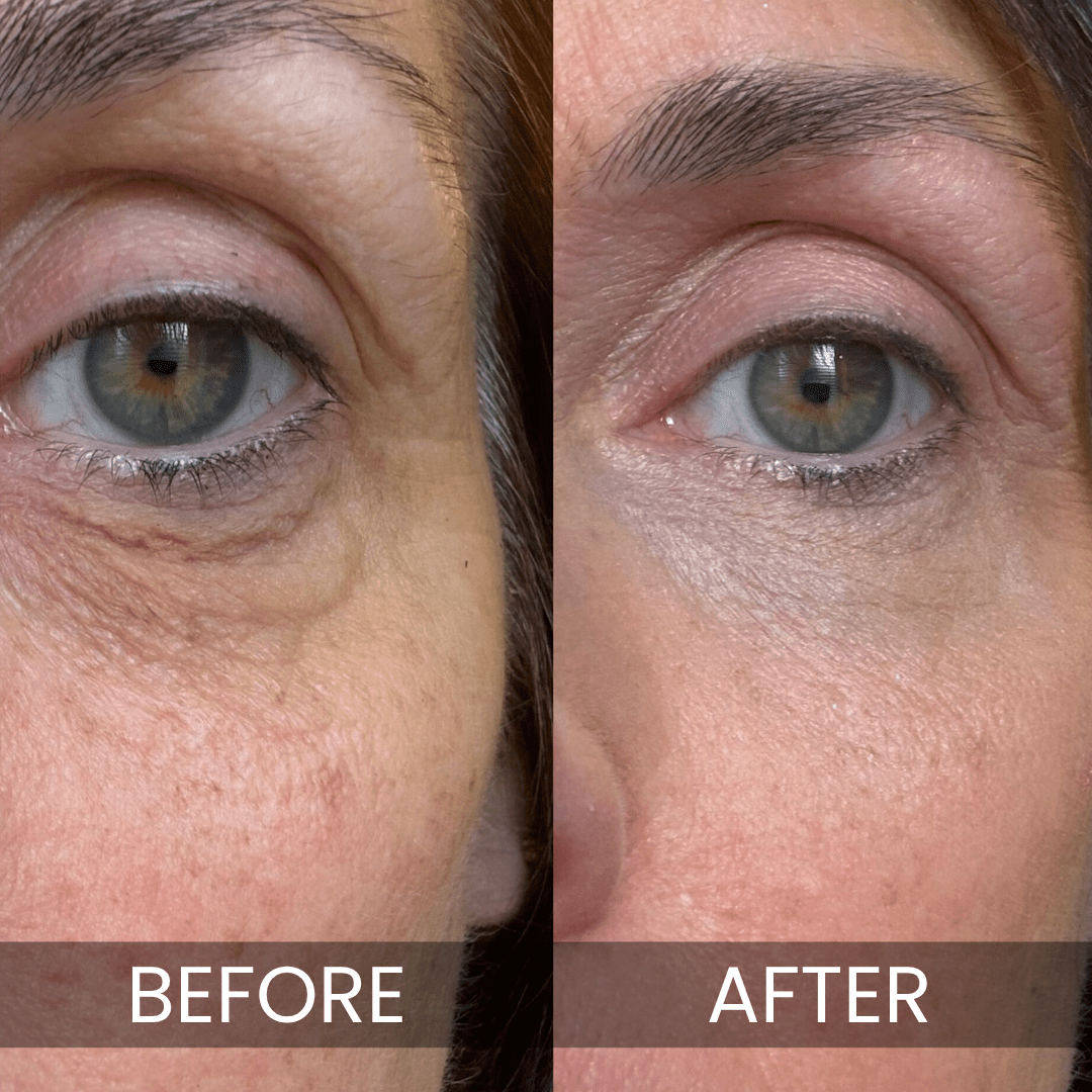Luxe - Korean Under-Eye Balm - The Closet